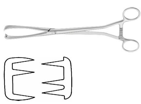 КОРНЦАНГ МЮЗУКС ЗАХОПЛЮЮЧИЙ, ПРЯМИЙ, 265 ММ